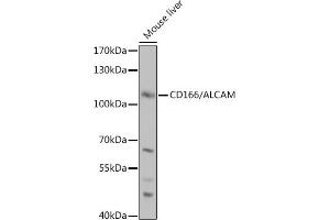 Western blot analysis of extracts of Mouse liver, using CD166/CD166/ALCAM antibody (ABIN6127405, ABIN6136759, ABIN6136760 and ABIN6219454) at 1:1000 dilution. (CD166 Antikörper  (AA 28-180))