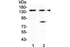 Western blot testing of 1) mouse liver and 2) human A431 lysate with FBXL11 antibody at 0. (KDM2A Antikörper)