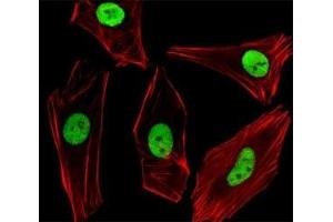Fluorescent image of SH-SY5Y cells stained with SUMO2/3 antibody diluted at 1:100 dilution. (SUMO2/3 Antikörper  (AA 49-81))