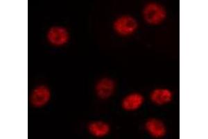 ABIN6275192 staining LOVO by IF/ICC. (HOXA6 Antikörper  (Internal Region))