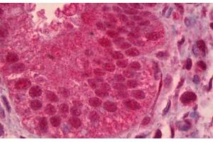 Anti-PAX9 antibody IHC staining of human uterus, endometrium. (PAX9 Antikörper)