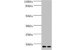Western blot All lanes: RPS19 antibody at 2 μg/mL Lane 1: EC109 whole cell lysate Lane 2: 293T whole cell lysate Secondary Goat polyclonal to rabbit IgG at 1/15000 dilution Predicted band size: 17 kDa Observed band size: 17 kDa (RPS19 Antikörper  (AA 1-145))
