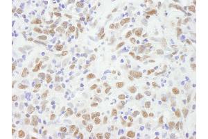Immunohistochemistry (IHC) image for anti-Chromobox Homolog 5 (CBX5) (C-Term) antibody (ABIN7448461)