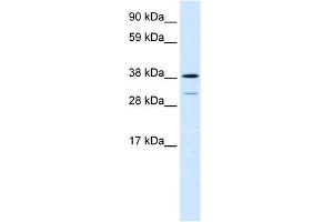 WB Suggested Anti-TCFL1 Antibody Titration:  0. (VPS72 Antikörper  (Middle Region))