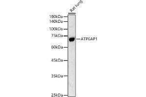 Western blot analysis of extracts of Rat lung, using  antibody (ABIN3021729, ABIN3021730, ABIN3021731 and ABIN6215663) at 1:500 dilution. (ATP6AP1 Antikörper  (AA 90-390))