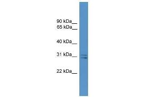 Western Blot showing SNAP29 antibody used at a concentration of 1-2 ug/ml to detect its target protein. (SNAP29 Antikörper  (Middle Region))