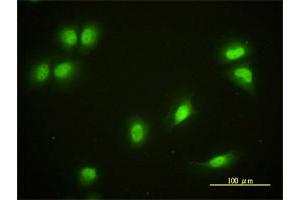 Immunofluorescence of monoclonal antibody to CRY1 on HeLa cell. (CRY1 Antikörper  (AA 1-586))