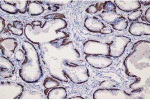 Immunohistochemistry (IHC) image for anti-Keratin 14 (KRT14) (C-Term) antibody (ABIN870552) (KRT14 Antikörper  (C-Term))