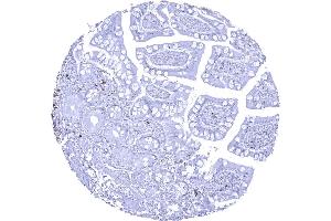 CD22 positive B lymphocytes are rare in this sample of ileum mucosa (Rekombinanter CD22 Antikörper  (AA 52-178))