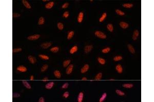 Immunofluorescence analysis of U-2 OS cells using ARID1B Polyclonal Antibody at dilution of 1:100. (ARID1B Antikörper)