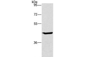 Western Blot analysis of HT-29 cell using GCK Polyclonal Antibody at dilution of 1:450 (GCK Antikörper)