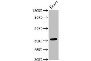 Western Blot Positive WB detected in: Rat heart tissue All lanes: NMI antibody at 3. (NMI Antikörper  (AA 62-202))
