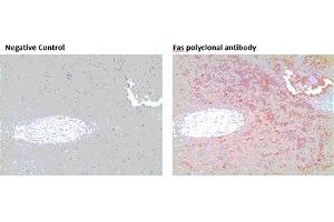 Immunohistochemistry analysis of formalin-fixed, paraffin-embedded human spleen tissue stained with Fas polyclonal antibody,  at 10 μg/mL. (FAS Antikörper)