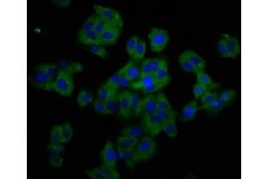 Immunofluorescence staining of HepG2 cells with ABIN7173864 at 1:200, counter-stained with DAPI. (TNFRSF19 Antikörper  (AA 276-415))
