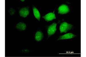 Immunofluorescence of purified MaxPab antibody to PSMB8 on HeLa cell.