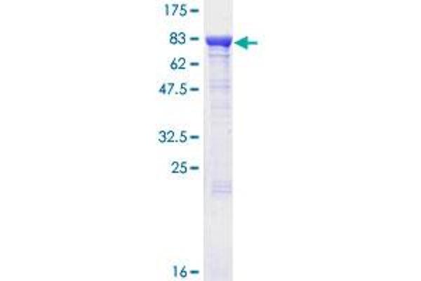 FEM1B Protein (AA 1-627) (GST tag)