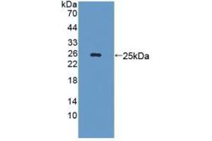 Detection of Recombinant LAMb3, Mouse using Polyclonal Antibody to Laminin Beta 3 (LAMb3) (Laminin beta 3 Antikörper  (AA 367-568))