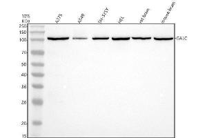 Western blot analysis of GALC using anti-GALC antibody (ABIN7825389).