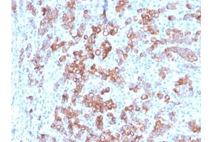 Formalin-fixed, paraffin-embedded human Adrenal stained with TIM3 Mouse Monoclonal Antibody (TIM3/3113). (TIM3 Antikörper  (AA 22-202))