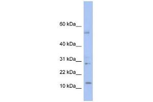 TD1 antibody used at 1 ug/ml to detect target protein. (TLX1 Neighbor Antikörper  (Middle Region))