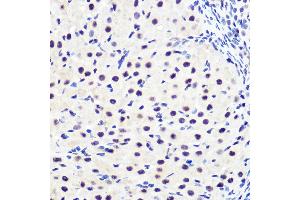 Immunohistochemistry of paraffin-embedded rat ovary using Phospho-IκBα-S36 Rabbit mAb (ABIN7268992) at dilution of 1:100 (40x lens). (NFKBIA Antikörper  (pSer36))