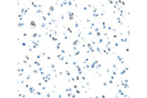 Immunocytochemistry (ICC) image for anti-Poly (ADP-Ribose) Polymerase 1 (PARP1) (AA 750-800) antibody (ABIN7449531)