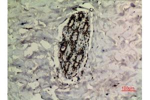 Immunohistochemistry (IHC) image for anti-Tumor Protein P73 (TP73) (acLys321) antibody (ABIN3181893)