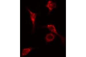 ABIN6278632 staining Hela cells by IF/ICC. (RPL14 Antikörper  (Internal Region))