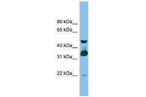 GBL antibody used at 1 ug/ml to detect target protein. (GBL Antikörper)
