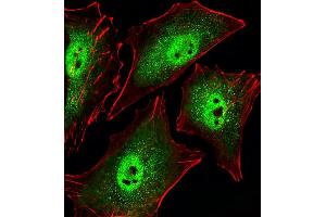 Fluorescent image of A549 cells stained with Mouse Sirt1 Antibody (C-term) (ABIN6242824 and ABIN6577619). (SIRT1 Antikörper  (C-Term))