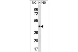 Western blot analysis in NCI-H460 cell line lysates (35ug/lane). (OR52N5 Antikörper  (C-Term))