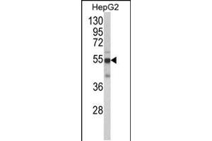 Western blot analysis of CYP2J2 Antibody in HepG2 cell line lysates (35ug/lane) (CYP2J2 Antikörper  (N-Term))