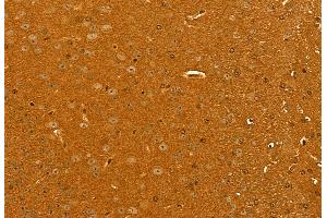 ABIN6262030 and ABIN6272943 at 1/100 staining Mouse brain tissue by IHC-P. (GOLPH3 Antikörper  (C-Term))