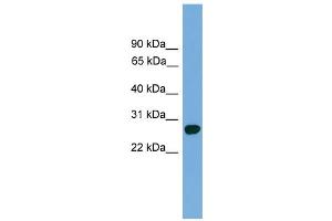WB Suggested Anti-Abt1 Antibody Titration: 0. (Activator of Basal Transcription 1 Antikörper  (C-Term))