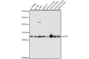 ETFB Antikörper  (AA 80-230)