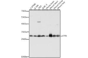 Western blot analysis of extracts of various cell lines, using ETFB antibody (ABIN7266916) at 1:1000 dilution. (ETFB Antikörper  (AA 80-230))