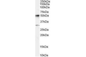 Image no. 1 for anti-Activating Transcription Factor 2 (ATF2) (C-Term) antibody (ABIN374122) (ATF2 Antikörper  (C-Term))
