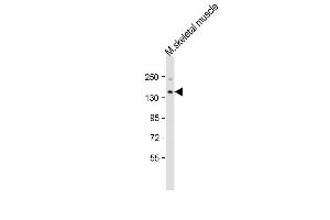 Anti-Jarid2 Antibody (C-term)at 1:2000 dilution + mouse skeletal muscle lysates Lysates/proteins at 20 μg per lane.
