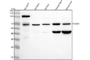 Western blot analysis of INSM2 using anti-INSM2 antibody (ABIN7599727).