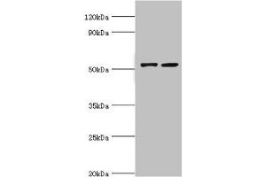 Western blot All lanes: CBLC antibody at 14 μg/mL Lane 1: A549 whole cell lysate Lane 2: Hela whole cell lysate Secondary Goat polyclonal to rabbit IgG at 1/10000 dilution Predicted band size: 53, 48 kDa Observed band size: 53 kDa (CBLC Antikörper  (AA 245-474))