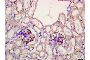 Immunohistochemistry (IHC) image for anti-Low Density Lipoprotein Receptor-Related Protein 2 (LRP2) (AA 3401-3500) antibody (ABIN750988)