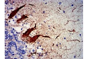 Immunohistochemistry (IHC) image for anti-Neurofilament, Heavy Polypeptide (NEFH) (AA 2-251) antibody (ABIN7193619)