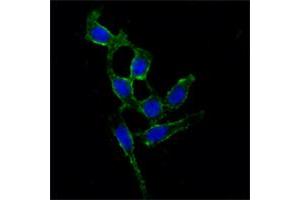 Immunofluorescence analysis of A549 cells using FAK mouse mAb (green). (FAK Antikörper)