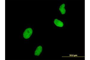 Immunofluorescence of monoclonal antibody to UHRF1 on HeLa cell. (UHRF1 Antikörper  (AA 694-793))