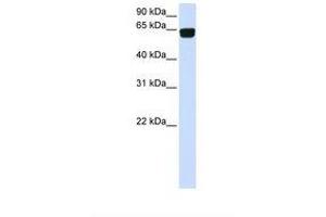 Image no. 1 for anti-Phosphatidylinositol Glycan T (PIGT) (AA 434-483) antibody (ABIN6738311) (PIGT Antikörper  (AA 434-483))