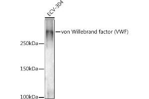 Western blot analysis of extracts of ECV-304 cells, using von Willebrand factor (VWF) antibody (ABIN3015449, ABIN3015450, ABIN5663874 and ABIN6217310) at 1:1000 dilution. (VWF Antikörper  (AA 50-150))