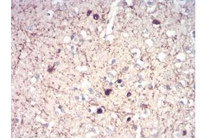 Immunohistochemical analysis of paraffin-embedded brain tissues using CALB2 mouse mAb with DAB staining. (Calretinin Antikörper  (AA 1-271))