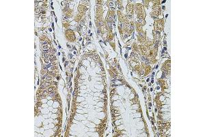 Immunohistochemistry of paraffin-embedded human stomach using PDCD6IP antibody (ABIN1874065) at dilution of 1:100 (40x lens).