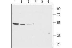 Western blot analysis of rat brain membrane (lanes 1 and 4), mouse brain (lanes 2 and 5) and mouse kidney lysates (lanes 3 and 6): - 1-3. (KCNJ13 Antikörper  (Extracellular Loop))