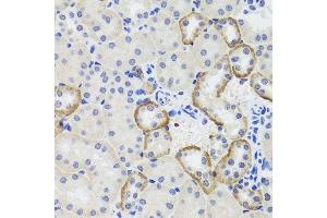 Immunohistochemistry of paraffin-embedded mouse kidney using MTERFD3 antibody. (MTERFD3 Antikörper  (AA 1-250))